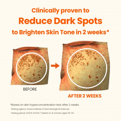 Vitamin Brightening Serum 10ml - Reduce Hyperpigmentation, Correct Dark Spot, Brightening Skin Tone